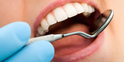 Zubní hygiena 1